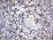 Melanoma Cell Adhesion Molecule antibody, LS-C789906, Lifespan Biosciences, Immunohistochemistry paraffin image 