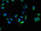 Major Histocompatibility Complex, Class I, C antibody, LS-C285744, Lifespan Biosciences, Immunofluorescence image 