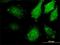 Mitogen-Activated Protein Kinase Kinase Kinase 20 antibody, H00051776-M02, Novus Biologicals, Immunocytochemistry image 