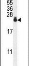 Adaptor Related Protein Complex 1 Subunit Sigma 3 antibody, PA5-23894, Invitrogen Antibodies, Western Blot image 