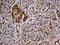 Inhibitor Of Nuclear Factor Kappa B Kinase Regulatory Subunit Gamma antibody, LS-C796361, Lifespan Biosciences, Immunohistochemistry paraffin image 