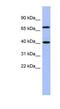 SLAIN Motif Family Member 2 antibody, NBP1-55242, Novus Biologicals, Western Blot image 