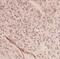 AUP1 Lipid Droplet Regulating VLDL Assembly Factor antibody, FNab00745, FineTest, Immunohistochemistry paraffin image 