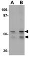 Kruppel Like Factor 4 antibody, GTX31798, GeneTex, Western Blot image 