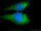 Nestin antibody, 66259-1-Ig, Proteintech Group, Immunofluorescence image 