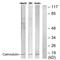 Calmodulin antibody, LS-C117835, Lifespan Biosciences, Western Blot image 