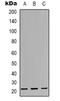 Core-Binding Factor Subunit Beta antibody, LS-C368668, Lifespan Biosciences, Western Blot image 