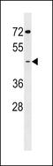 Glucosaminyl (N-Acetyl) Transferase Family Member 7 antibody, LS-C159722, Lifespan Biosciences, Western Blot image 