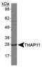 THAP Domain Containing 11 antibody, PA5-23050, Invitrogen Antibodies, Western Blot image 