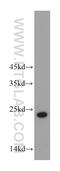 Abhydrolase Domain Containing 14B antibody, 20952-1-AP, Proteintech Group, Western Blot image 