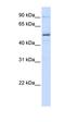 Zinc Finger Protein 275 antibody, orb325657, Biorbyt, Western Blot image 