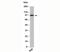 TLR4 Interactor With Leucine Rich Repeats antibody, 33-032, ProSci, Western Blot image 