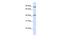 Thioredoxin Related Transmembrane Protein 4 antibody, PA5-43385, Invitrogen Antibodies, Western Blot image 