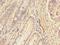 Endoplasmic Reticulum-Golgi Intermediate Compartment 1 antibody, LS-C371760, Lifespan Biosciences, Immunohistochemistry paraffin image 