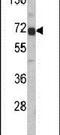Alpha Fetoprotein antibody, PA5-11480, Invitrogen Antibodies, Western Blot image 