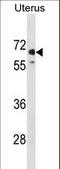 Membrane Metalloendopeptidase Like 1 antibody, LS-C157890, Lifespan Biosciences, Western Blot image 