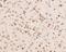 Lamin A/C antibody, NBP2-80464, Novus Biologicals, Immunohistochemistry paraffin image 