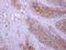 Dihydropyrimidine Dehydrogenase antibody, LS-C186323, Lifespan Biosciences, Immunohistochemistry paraffin image 