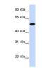 Carcinoembryonic Antigen Related Cell Adhesion Molecule 16 antibody, NBP1-70492, Novus Biologicals, Western Blot image 