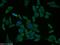 Glycogen Phosphorylase L antibody, 15851-1-AP, Proteintech Group, Immunofluorescence image 