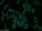 Glycogen phosphorylase, liver form antibody, 15851-1-AP, Proteintech Group, Immunofluorescence image 