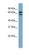 TNF Alpha Induced Protein 8 Like 3 antibody, orb186312, Biorbyt, Western Blot image 