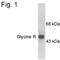 Glycine Receptor Alpha 1 antibody, PA1-4661, Invitrogen Antibodies, Western Blot image 