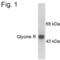 Glycine Receptor Alpha 1 antibody, PA1-4661, Invitrogen Antibodies, Western Blot image 