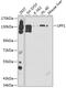 UPF1 RNA Helicase And ATPase antibody, GTX16390, GeneTex, Western Blot image 