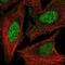 Homeobox protein Hox-D3 antibody, NBP2-56817, Novus Biologicals, Immunofluorescence image 