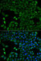 Citrin antibody, 14-506, ProSci, Immunofluorescence image 