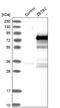 Zinc Finger And BTB Domain Containing 2 antibody, NBP1-88786, Novus Biologicals, Western Blot image 