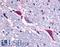 TACR3 antibody, LS-A4147, Lifespan Biosciences, Immunohistochemistry frozen image 