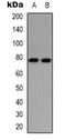 Protein Kinase C Delta antibody, orb338908, Biorbyt, Western Blot image 