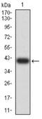 SUZ12 Polycomb Repressive Complex 2 Subunit antibody, NBP2-61892, Novus Biologicals, Western Blot image 