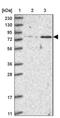 Zinc Finger Protein 526 antibody, NBP2-32007, Novus Biologicals, Western Blot image 
