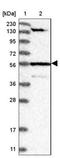 Dynein Regulatory Complex Subunit 3 antibody, NBP1-84128, Novus Biologicals, Western Blot image 