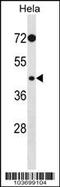 Phosphorylase Kinase Catalytic Subunit Gamma 2 antibody, 62-745, ProSci, Western Blot image 