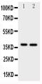 MCL1 Apoptosis Regulator, BCL2 Family Member antibody, PA1503, Boster Biological Technology, Western Blot image 
