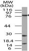 TGF-Beta Activated Kinase 1 (MAP3K7) Binding Protein 3 antibody, A05084, Boster Biological Technology, Western Blot image 