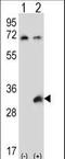 Testis Specific Serine Kinase 6 antibody, LS-C160283, Lifespan Biosciences, Western Blot image 