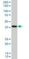 PDZ And LIM Domain 2 antibody, H00064236-B01P, Novus Biologicals, Western Blot image 