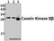 Casein Kinase 2 Beta antibody, A03475S205, Boster Biological Technology, Western Blot image 