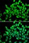 Alsin Rho Guanine Nucleotide Exchange Factor ALS2 antibody, LS-C346241, Lifespan Biosciences, Immunofluorescence image 