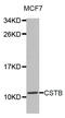Cystatin B antibody, abx002766, Abbexa, Western Blot image 