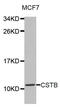 Stefin-B antibody, abx002766, Abbexa, Western Blot image 