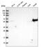 Keratin 6B antibody, NBP2-54726, Novus Biologicals, Western Blot image 