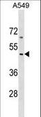 Collagen Type XXVI Alpha 1 Chain antibody, LS-C159527, Lifespan Biosciences, Western Blot image 