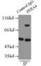 Protein Disulfide Isomerase Family A Member 4 antibody, FNab02859, FineTest, Immunoprecipitation image 