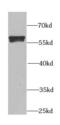 Aldehyde Dehydrogenase 1 Family Member A2 antibody, FNab00285, FineTest, Western Blot image 